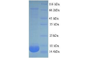 Image no. 1 for Phospholipase A2, Group IIA (Platelets, Synovial Fluid) (PLA2G2A) (AA 22-146) protein (His tag) (ABIN5714042)