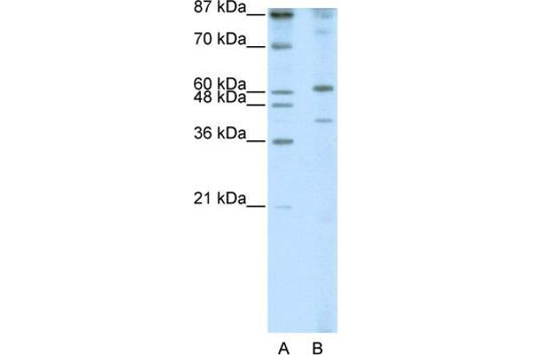 anti-REX4, RNA Exonuclease 4 Homolog (REXO4) (N-Term) antibody