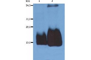 Image no. 2 for anti-CD59 (CD59) antibody (ABIN94203)