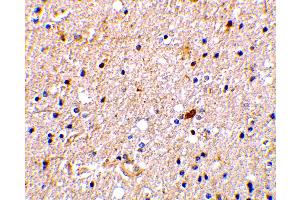Image no. 2 for anti-Nerve Growth Factor Receptor (TNFRSF16) Associated Protein 1 (NGFRAP1) (Internal Region) antibody (ABIN6655890)
