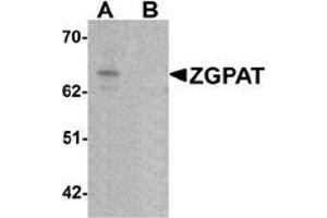 Image no. 2 for anti-Zinc Finger, CCCH-Type with G Patch Domain (ZGPAT) (C-Term) antibody (ABIN1450081)