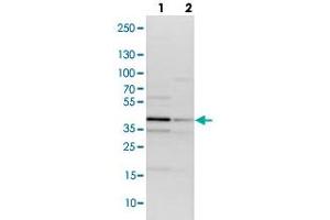 Image no. 3 for anti-Tribbles Pseudokinase 2 (TRIB2) antibody (ABIN5590135)