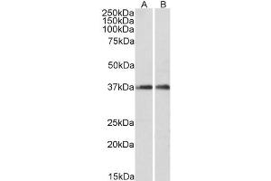 Image no. 2 for anti-Actin Related Protein 2/3 Complex, Subunit 1A, 41kDa (ARPC1A) (C-Term) antibody (ABIN5539619)
