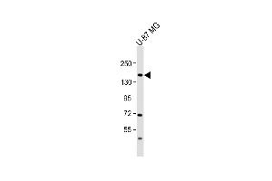Anti-ADTS20 Antibody (Center) at 1:2000 dilution + U-87 MG whole cell lysate Lysates/proteins at 20 μg per lane.