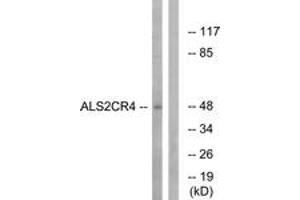 Image no. 1 for anti-Transmembrane Protein 237 (TMEM237) (AA 181-230) antibody (ABIN1534632)