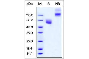 Image no. 2 for CD47 (CD47) (AA 19-141) (Active) protein (Fc Tag) (ABIN4949054)