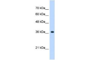 Image no. 1 for anti-alpha-1,4-N-Acetylglucosaminyltransferase (A4GNT) (C-Term) antibody (ABIN635982)
