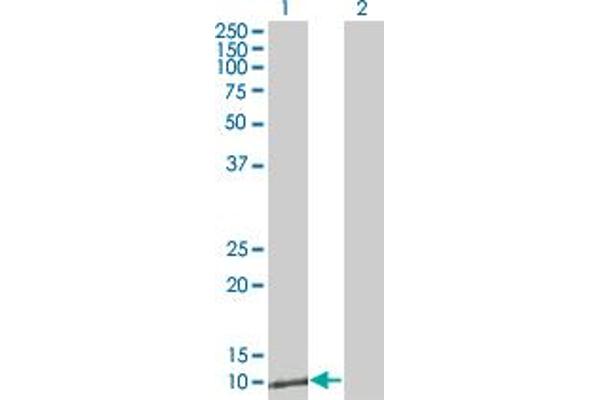 anti-Zinc Ribbon Domain Containing 1 (ZNRD1) (AA 24-126) antibody