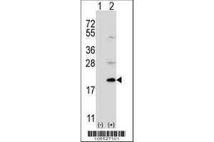 Image no. 2 for anti-Ubiquitin-Fold Modifier Conjugating Enzyme 1 (UFC1) (C-Term) antibody (ABIN650703)