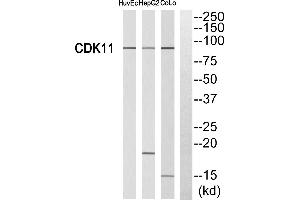 Image no. 1 for anti-Cyclin-Dependent Kinase 11B (CDK11B) (Internal Region) antibody (ABIN1575525)