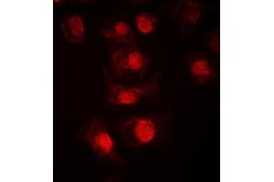 Image no. 1 for anti-MAX-Like Protein X (MLX) (Center) antibody (ABIN2707153)