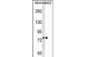 PNPT1 Antibody (Center) (ABIN1538242 and ABIN2849157) western blot analysis in MDA-M cell line lysates (35 μg/lane).