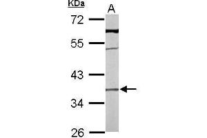 Image no. 5 for anti-Transmembrane Protein 59 (TMEM59) (Center) antibody (ABIN2855840)