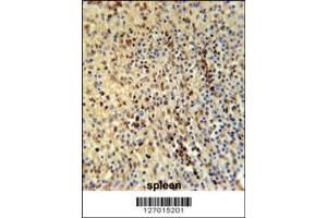 Image no. 2 for anti-Spermatogenesis Associated 13 (SPATA13) (Center) antibody (ABIN2503417)