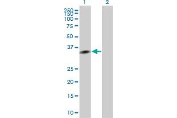 anti-Exosome Component 7 (EXOSC7) (AA 1-291) antibody