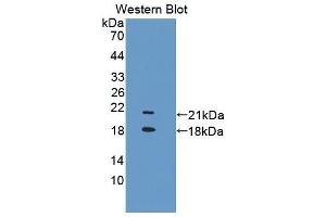 Image no. 2 for anti-Transient Receptor Potential Cation Channel, Subfamily V, Member 6 (TRPV6) (AA 578-725) antibody (ABIN5014440)