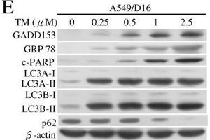 Analyses of GMI, TG and TM regulated ER stress, apoptosis and autophagy by Western blotting.