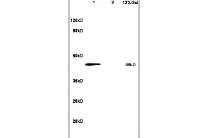 Image no. 1 for anti-phosphorylase Kinase, gamma 2 (Testis) (PHKG2) (AA 81-180) antibody (ABIN708326)