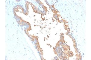 Image no. 3 for anti-Transferrin (TF) (AA 311-445) antibody (ABIN6940685)