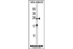 Image no. 1 for anti-Male Enhanced Antigen 1 (MEA1) (AA 19-48), (N-Term) antibody (ABIN657238)