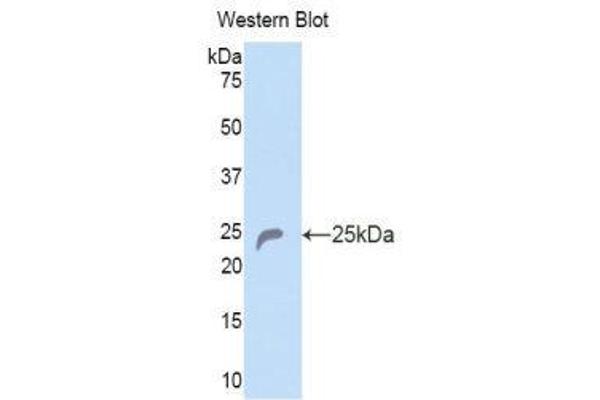 COL6A1 antibody  (AA 816-1002)