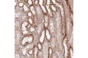 Image no. 1 for anti-Zinc Finger Protein 623 (ZNF623) antibody (ABIN5591408)