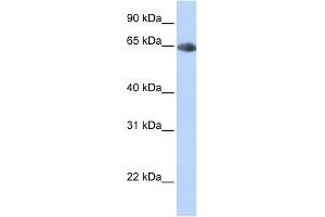 Image no. 1 for anti-Solute Carrier Family 6 (Neurotransmitter Transporter, Noradrenalin), Member 2 (SLC6A2) (Middle Region) antibody (ABIN2777051)