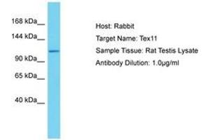 Image no. 1 for anti-Testis Expressed 11 (TEX11) (AA 39-88) antibody (ABIN6750355)