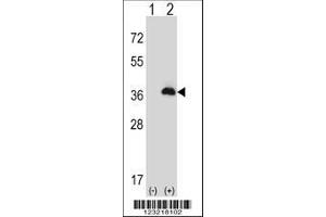 Image no. 2 for anti-Peroxisomal Biogenesis Factor 16 (PEX16) (AA 247-275) antibody (ABIN653096)
