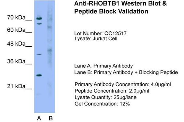 RHOBTB1 antibody  (Middle Region)