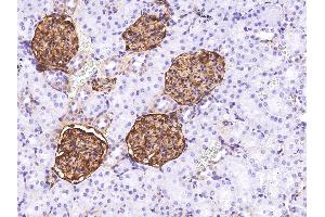 Image no. 2 for anti-Basal Cell Adhesion Molecule (Lutheran Blood Group) (BCAM) (AA 1-543) antibody (ABIN2649549)
