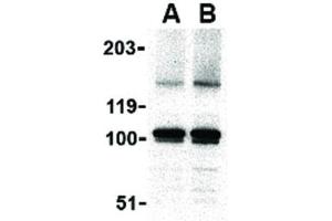 Image no. 3 for anti-Elongator Complex Protein 1 (ELP1) (C-Term) antibody (ABIN6655858)