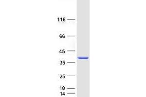 ETV7 Protein (Myc-DYKDDDDK Tag)