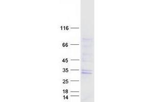 GTPBP8 Protein (GTP-Binding Protein 8) (Transcript Variant 1) (Myc-DYKDDDDK Tag)