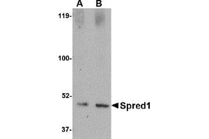 Image no. 1 for anti-Sprouty-Related, EVH1 Domain Containing 1 (SPRED1) (Middle Region 2) antibody (ABIN1031204)
