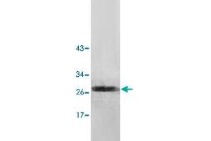 Western blot analysis of human fetal brain lysate with NUDT7 polyclonal antibody  at 1 : 500 dilution.