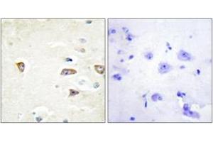 Image no. 1 for anti-CDC42 Binding Protein Kinase beta (DMPK-Like) (CDC42BPB) (AA 1641-1690) antibody (ABIN1534220)