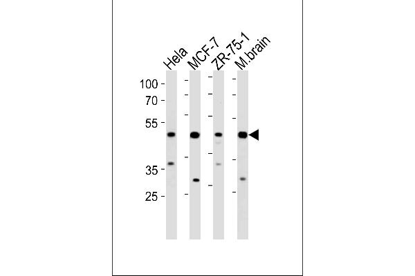 FBXO28 Antikörper  (C-Term)