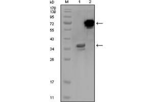 Image no. 1 for anti-Hermansky-Pudlak Syndrome 1 (HPS1) antibody (ABIN1107599)
