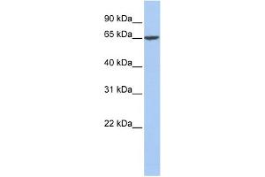 Image no. 1 for anti-Fibrinogen alpha Chain (FGA) (Middle Region) antibody (ABIN2776978)