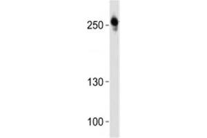 Image no. 2 for anti-C-Ros Oncogene 1 , Receptor tyrosine Kinase (ROS1) (C-Term) antibody (ABIN3030232)