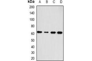Image no. 2 for anti-Hyaluronan Synthase 3 (HAS3) antibody (ABIN2966704)