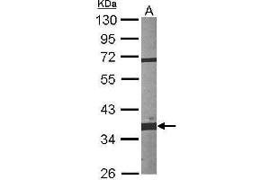 Image no. 4 for anti-Fibrillarin (FBL) (Center) antibody (ABIN2855179)