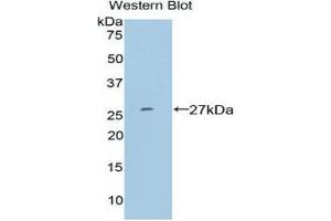 Image no. 1 for anti-SP100 Nuclear Antigen (SP100) (AA 261-465) antibody (ABIN1860601)