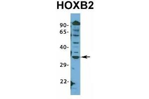 Image no. 2 for anti-Homeobox B2 (HOXB2) (N-Term) antibody (ABIN2776384)