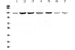 Image no. 1 for anti-SMC6 Structural Maintenance of Chromosomes 6-Like 1 (SMC6) (AA 205-443) antibody (ABIN5693133)