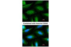 anti-F-Box and Leucine-Rich Repeat Protein 2 (FBXL2) (N-Term) antibody
