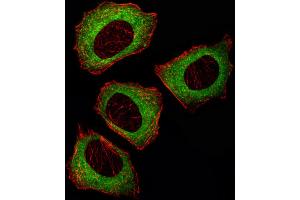 Image no. 5 for anti-Mitogen-Activated Protein Kinase Kinase 2 (MAP2K2) (Center) antibody (ABIN2448074)