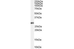 Image no. 1 for anti-Homeobox B13 (HOXB13) (C-Term) antibody (ABIN185732)