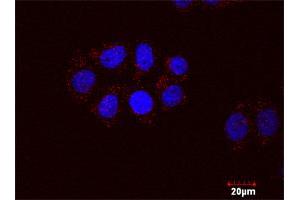 Proximity Ligation Assay (PLA) image for FYN & CTNNB1 Protein Protein Interaction Antibody Pair (ABIN1339897)